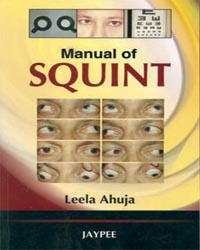 Manual of Squint| 1/e