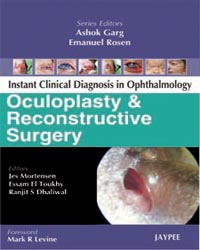 Instant Clinical Diagnosis in Ophthalmology: Oculoplasty and Reconstructive Surgery |1/e