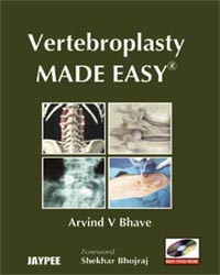 Vertebroplasty Made Easy with DVD-ROM|1/e