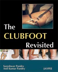 The Clubfoot Revisited|1/e