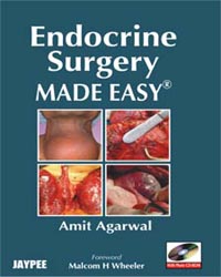 Endocrine Surgery Made Easy (with Photo CD-ROM)|1/e