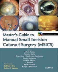 Master's Guide to Manual Small Incision Cataract Surgery (MSICS)|1/e
