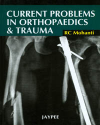 Current Problems in Orthopaedics & Trauma|1/e