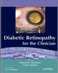 Diabetic Retinopathy for the Clinician|1/e