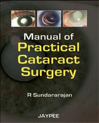 Manual of Practical Cataract Surgery|1/e