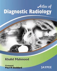Atlas of  Diagnostic Radiology|1/e