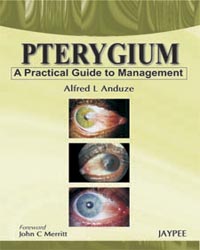 Pterygium: A Practical Guide to Management|1/e