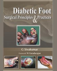 Diabetic Foot Surgical Principles and Practices|1/e