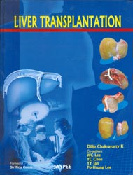 Liver Transplantation|1/e