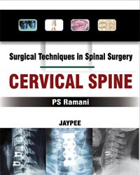 Surgical Techniques in Spinal Surgery Cervical Spine|1/e