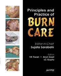 Principles and Practice of Burn Care|1/e