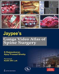 Jaypee's Ganga Video Atlas of Spine Surgery|1/e