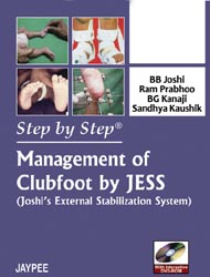 Step by Step Management of Clubfoot by Jess|1/e