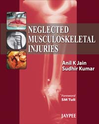 Neglected Musculoskeletal Injuries|1/e