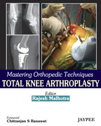 Mastering Orthopedic Techniques Total knee Arthroplasty|1/e