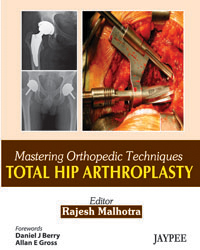 Mastering Orthopedic Techniques Total Hip Arthroplasty|1/e