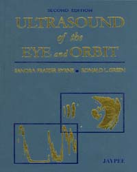 Ultrasound of the Eye and Orbit|2/e