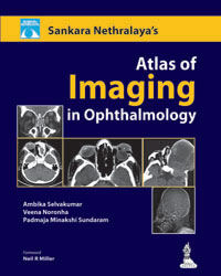 Sankara Nethralaya Atlas of Imaging in Ophthalmology|1/e