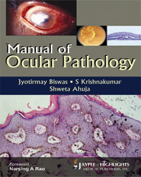 Manual of Ocular Pathology|1/e