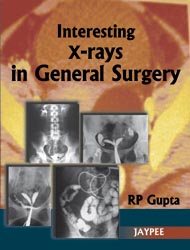 Interesting X-rays in General Surgery|1/e