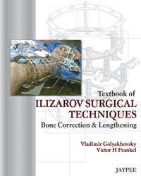 Textbook of Ilizarov Surgical Techniques: Bone Correction and Lengthening|1/e
