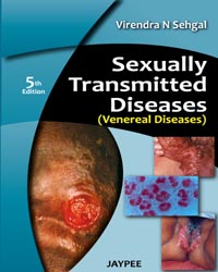 Sexually Transmitted Diseases|5/e