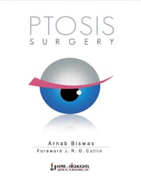 Ptosis Surgery|1/e