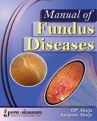 Manual of Fundus Diseases|1/e