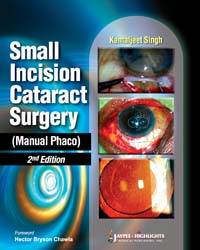 Small Incision Cataract Surgery (Manual Phaco)|2/e