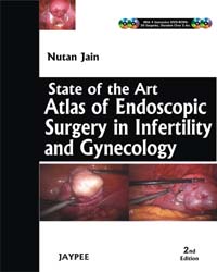State of the Art: Atlas and Endoscopy Surgery in Infertility and Gynecology (with 4 DVD-ROMs)|2/e