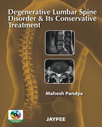 Degenerative lumbar Spine Disroder and its Conservative Treatment With DVD-Rom|1/e