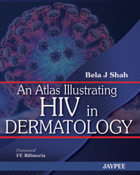 An Atlas Illustrating HIV in Dermatology|1/e