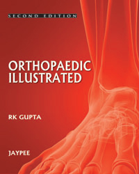 Orthopedics Illustrated|2/e