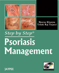 Step by Step Psoriasis Management|1/e