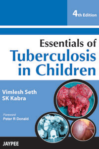 Essentials of Tuberculosis in Children|4/e