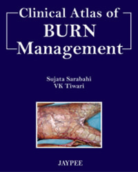 Clinical Atlas of Burn Management|1/e