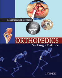 Orthopedics: Seeking a Balance|1/e
