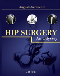 Hip Surgery|1/e