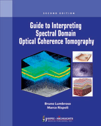 Guide to Interpreting Spectral Domain Optical Coherence Tomography|2/e