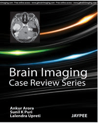 Brain Imaging: Case Review Series|1/e