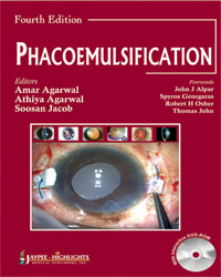 Phacoemulsification|4/e