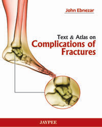 Text and Atlas on Complications of Fractures|1/e