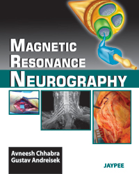 Magnetic Resonance Neurography|1/e