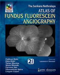 The Sankara Nethralaya: Atlas of Fundus Fluorescein Angiography|2/e