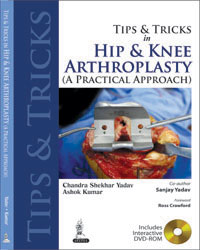 Tips and Tricks in Hip and Knee Arthroplasty|1/e