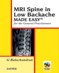 MRI Spine in Low Backache Made Easy: for the General Practitioner|1/e