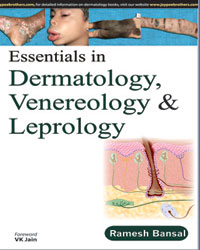 Essentials in Dermatology  Venereology & Leprology|1/e