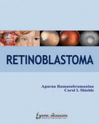 Retinoblastoma|1/e