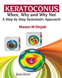 Keratoconus: When  Why and Why Not: A Step by Step Systematic Approach|1/e