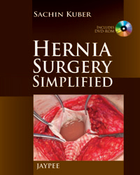 Hernia Surgery Simplified|1/e